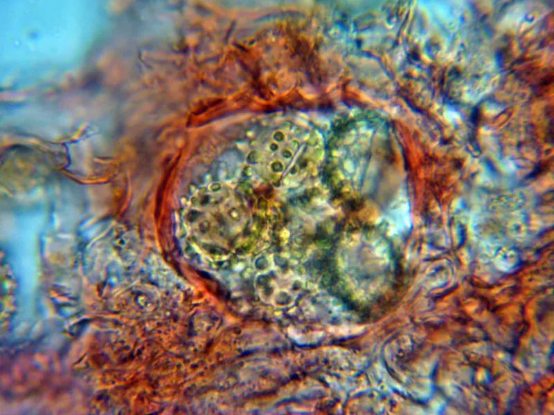 Choiromyces meandriformis 10 - Asca x 1000